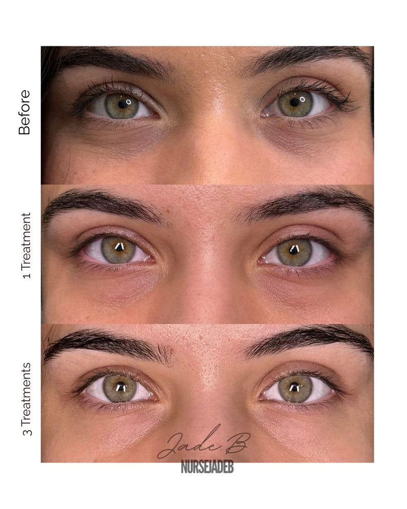 VAMP Undereye Treatment